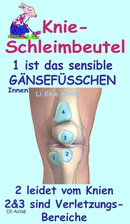 Schleimbeutel: Wichtige Polster, sensibel für Verletzungen, Dauerdruck